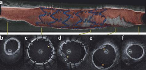      ,       OFDI.        (   Seok H. Yun et al.).