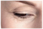 Советы по профилактике морщин вокруг глаз